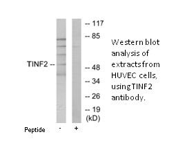 Product image for TINF2 Antibody