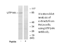 Product image for UTP14A Antibody