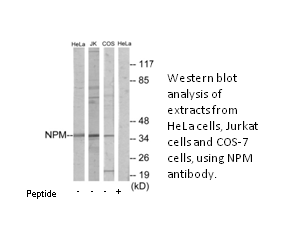 Product image for NPM Antibody
