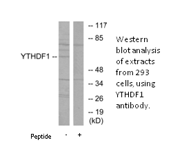 Product image for YTHDF1 Antibody
