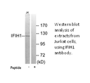 Product image for IFIH1 Antibody