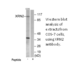 Product image for XRN2 Antibody