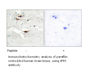 Product image for IPPK Antibody