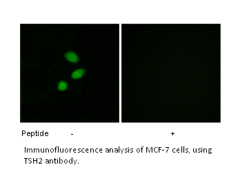 Product image for TSH2 Antibody