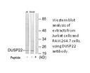 Product image for DUSP22 Antibody