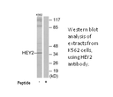 Product image for HEY2 Antibody