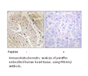 Product image for PRKAG2 Antibody