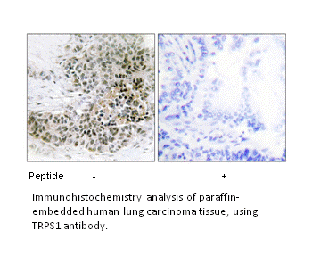 Product image for TRPS1 Antibody