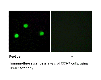 Product image for IP6K2 Antibody