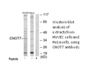 Product image for CNOT7 Antibody