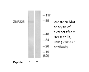 Product image for ZNF225 Antibody