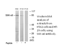 Product image for S6K-&alpha;6 Antibody