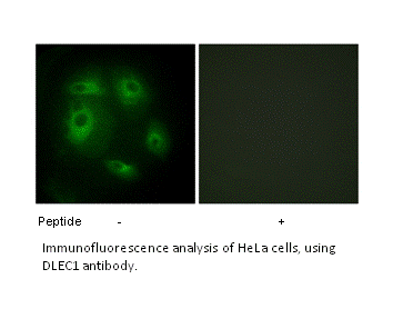 Product image for DLEC1 Antibody