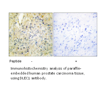 Product image for DLEC1 Antibody