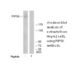 Product image for PIP5K Antibody