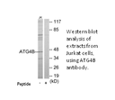 Product image for ATG4B Antibody