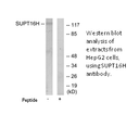 Product image for SUPT16H Antibody