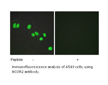 Product image for NCOR2 Antibody