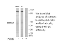 Product image for 5-HT-1A Antibody