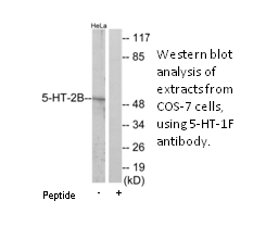 Product image for 5-HT-2B Antibody