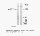 Product image for ADCY1 Antibody