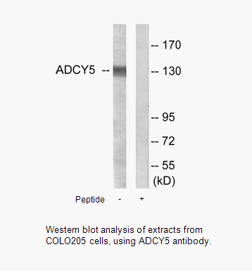 Product image for ADCY5/6 Antibody