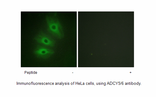 Product image for ADCY5/6 Antibody