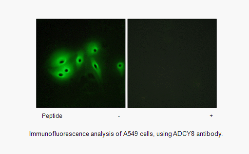 Product image for ADCY8 Antibody