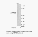 Product image for ADRB2 Antibody