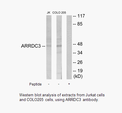 Product image for ARRDC3 Antibody