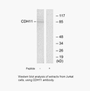Product image for CDH11 Antibody