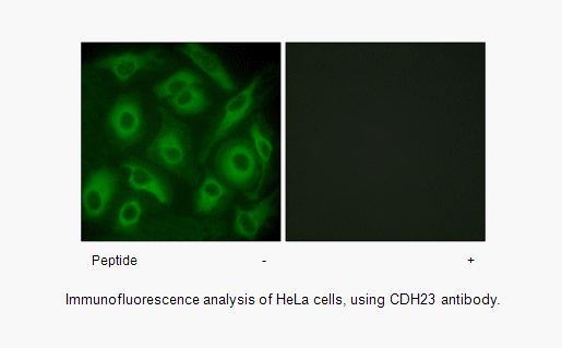 Product image for CDH23 Antibody