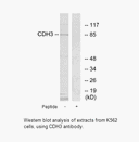 Product image for CDH3 Antibody