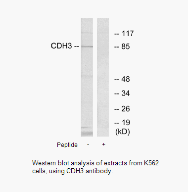 Product image for CDH3 Antibody