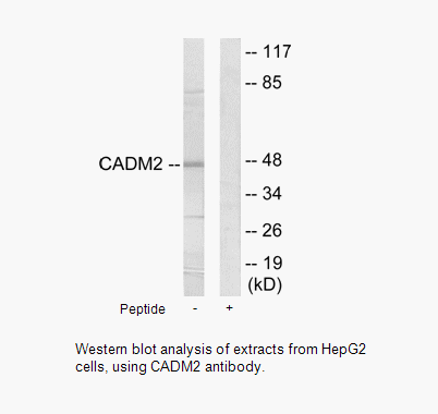 Product image for CADM2 Antibody
