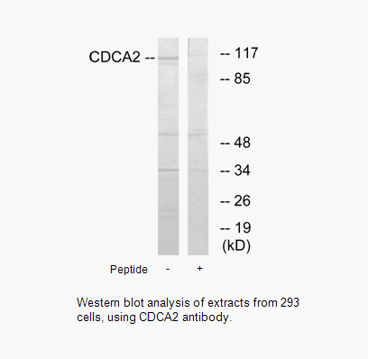 Product image for CDCA2 Antibody