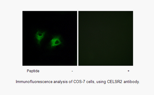 Product image for CELSR2 Antibody