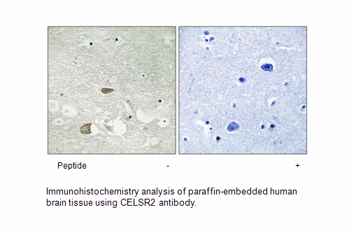 Product image for CELSR2 Antibody