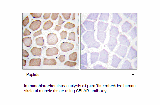 Product image for CFLAR Antibody