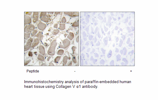 Product image for Collagen V &alpha;1 Antibody