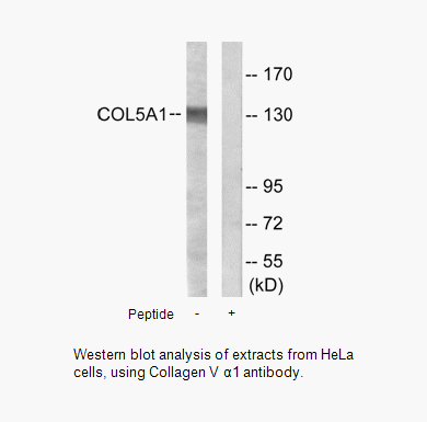 Product image for Collagen V &alpha;1 Antibody