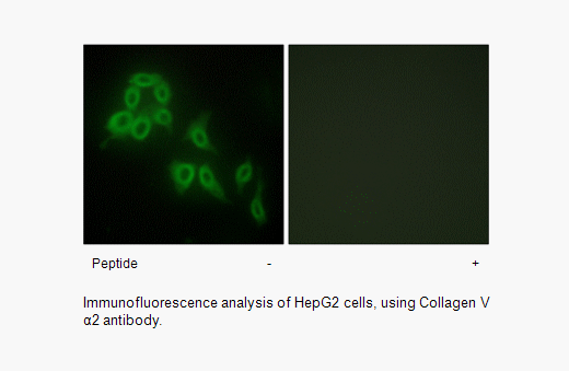 Product image for Collagen V &alpha;2 Antibody
