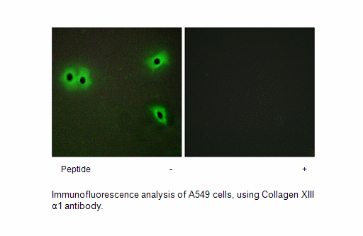 Product image for Collagen XIII &alpha;1 Antibody