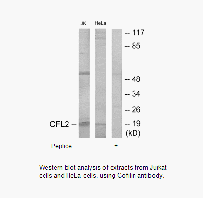 Product image for Cofilin Antibody