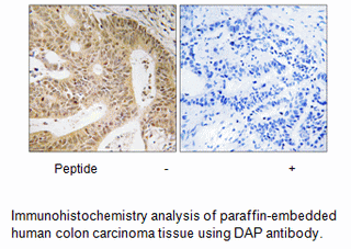 Product image for DAP Antibody