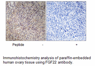 Product image for FGF22 Antibody