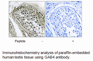 Product image for GAB4 Antibody