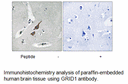 Product image for GRID1 Antibody