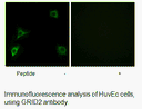 Product image for GRID2 Antibody