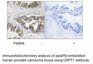 Product image for GSPT1 Antibody